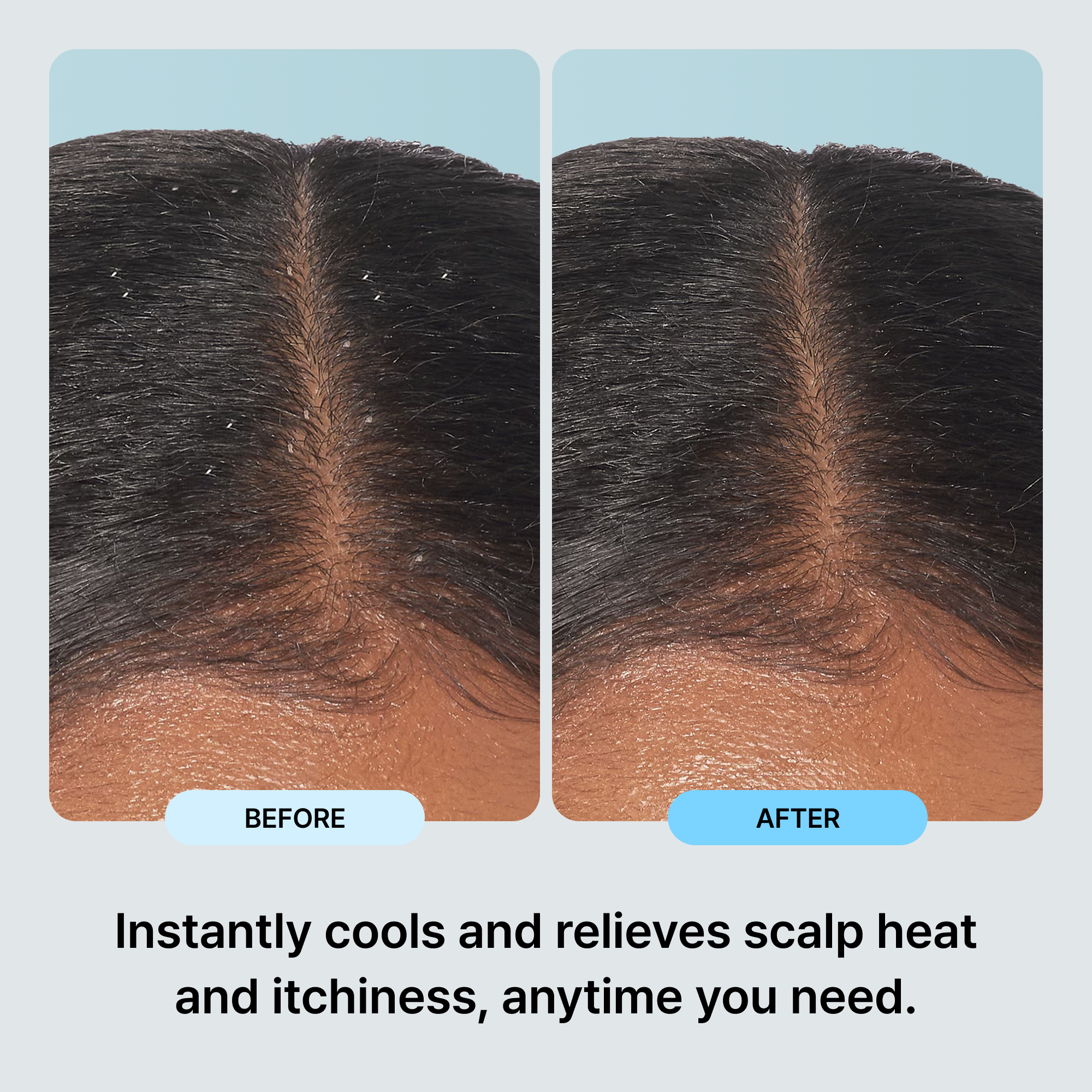 Yulmu Deep Scaling Scalp Swab