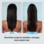 Yulmu Deep Scaling Scalp Swab